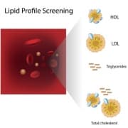 Lipoproteiner kolesterol