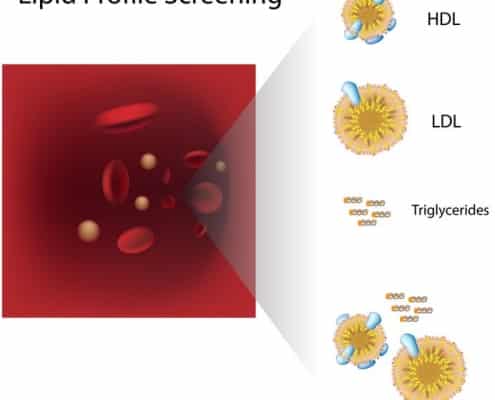 Lipoproteiner kolesterol